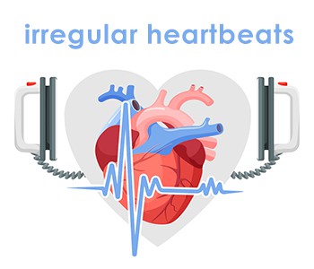 Que signifie avoir un rythme sinusal lors d'un examen physique ? L'arythmie e...