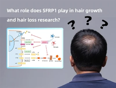 Quel rôle SFRP1 joue-t-il dans la recherche sur la croissance et la chute des...