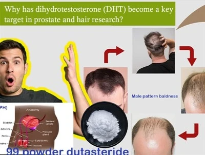 Pourquoi la DHT est-elle devenue une cible clé dans la recherche sur la prost...