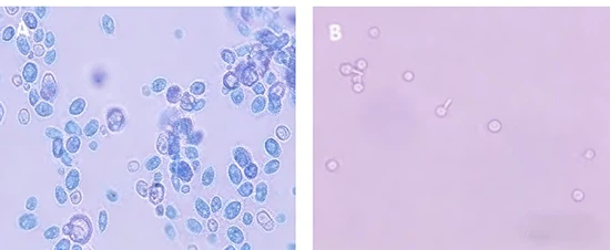 7199 powder Nystatin A 7199 powder Nystatin A